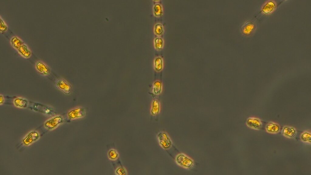 algae-1-ht-er-250401_1743531531520_hpMain_16x9.jpg